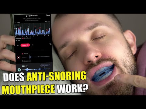 Honex Anti-Snoring Mouthpiece Honest Review - Does It Actually Help?