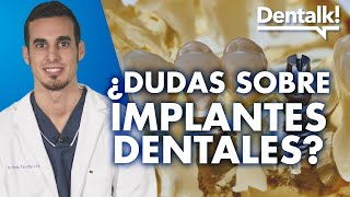 Implantes dentales: preguntas frecuentes – Dentalk! ©️ - Clínica Dental Pardiñas