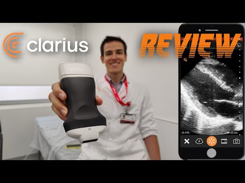 🔶 CLARIUS REVIEW 🔶 l POCUS Hand-held Ultrasound for Cardiac Echo!