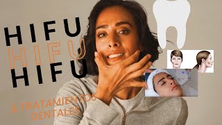 HIFU & Tratamientos dentales: ¿No puedes