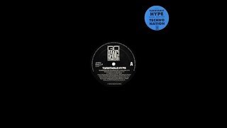 Turntable Hype   Techno Nation Vocal Attack