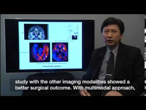 Application of PET and SPECT imaging in Epilepsy - Yotin Chinvarun