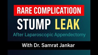 When Routine Appendectomy Goes Wrong | Rare Stump Leak Case | Laparoscopic Repair | Dr.Samrat Jankar
