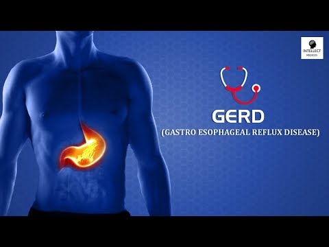 nustatyti lieknėjimo biudžetą prarasti maksimalų svorį per 6 savaites