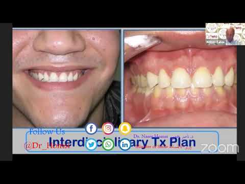 Melhor Palestra de Odontologia para Faculdade para Estudantes  Odontologia Dentistas Dr. Naser Homsi