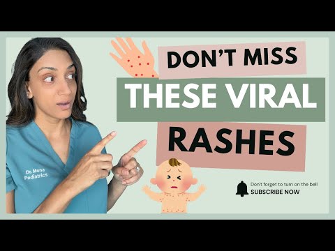 Measles vs Chickenpox in Kids: Symptoms, Treatment, and When to See a Doctor