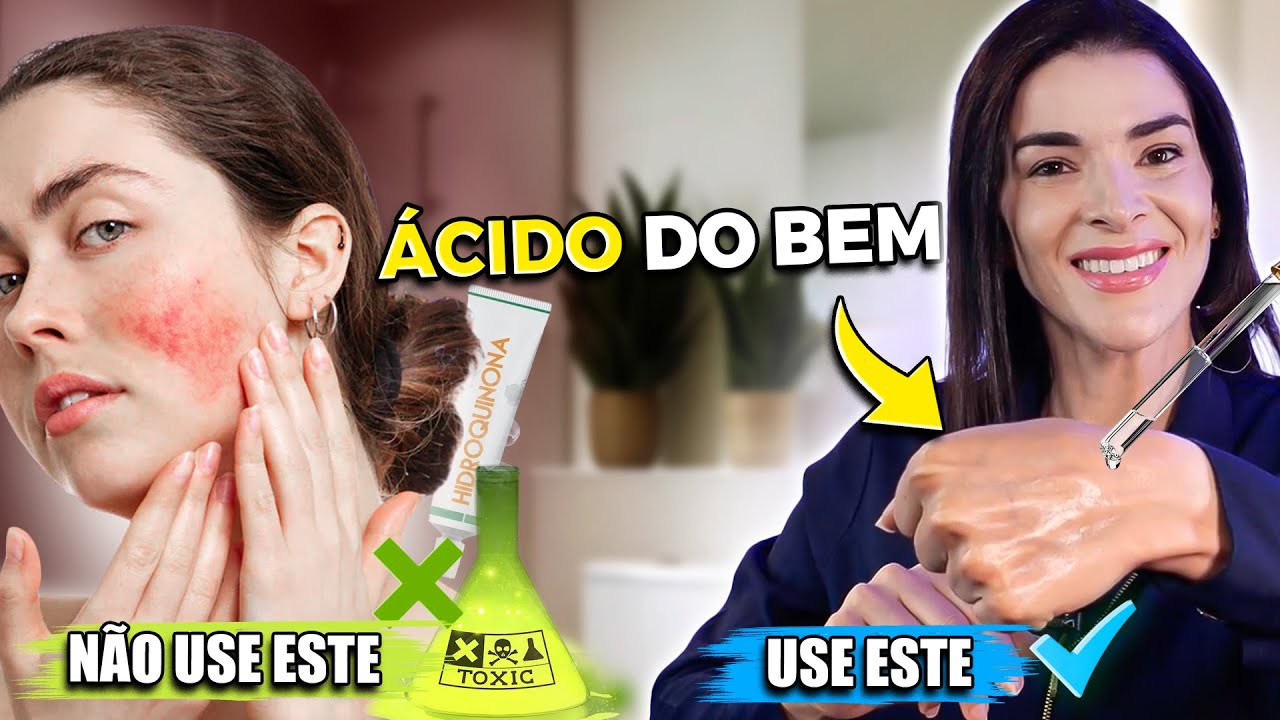 ÁCIDO 100% SEGURO que Clareia Manchas de Pele, inclusive Melasma!
