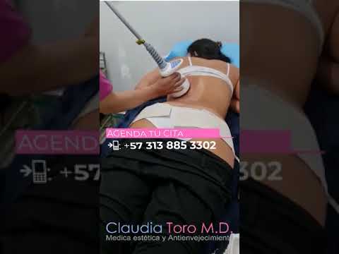 Tecnología estética Venus Legacy en Bogotá - Dra. Claudia Toro médica estética y antienvejecimiento