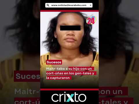 Maltrataba a su hijo con un cortaúñas en los genitales y la capturaron