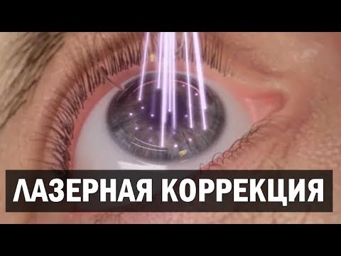 Потерял зрение после операции, как быть? Лазерная коррекция