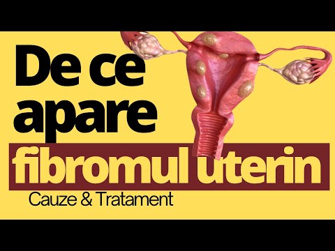 De ce facem FIBROM Uterin