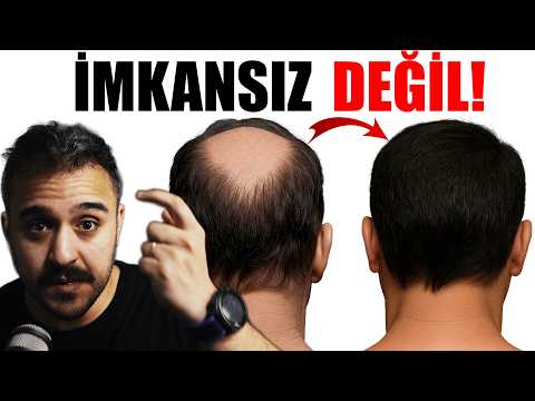 Dr. Can Çiftçi - Bağırsak Florası Bozukluğuna Bağlı Biotin Eksikliğinin Keratin Üretimini Durdurması