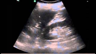 39yoF with ankle pain and abdominal pain