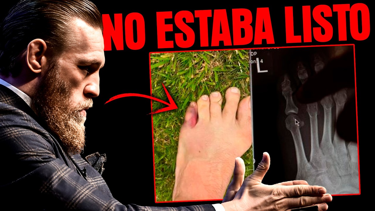 ¡2 AÑOS por un DEDO! ¡IMÁGENES OFICIALES de la LESIÓN de Conor McGregor!