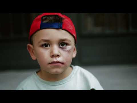 Nast Pura Sangre - Oportunistas (Videoclip Oficial)