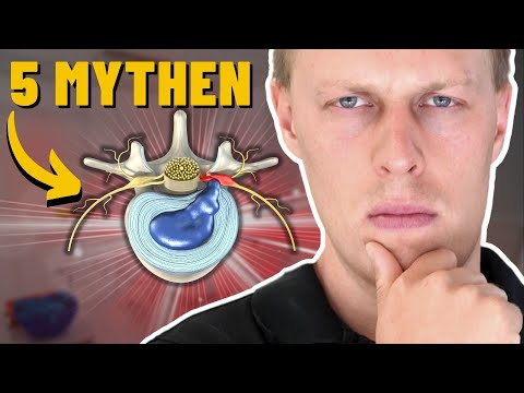 Herniated disc: THIS is what doctors are hiding from you! (intentionally)