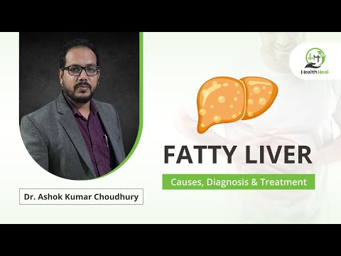 Fatty Liver Causes