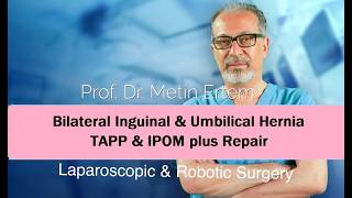 Miniaturka - Bilateral inguinal&Umbilical Hernia. TAPP & IPOM plus. Metin Ertem MD FACS.