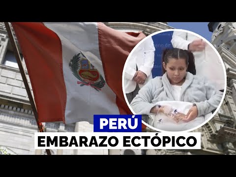 Perú registra el cuarto nacimiento en el mundo de un embarazo ectópico con bebé en el hígado