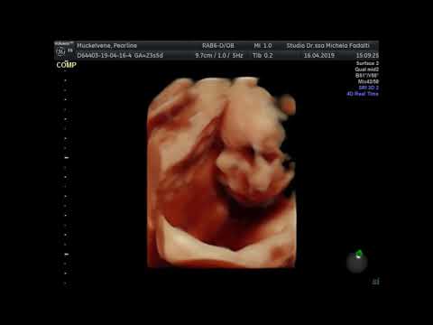 3D & 4D Ultrasound 24 Weeks | 6 Months Pregnant Video
