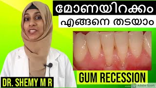How to prevent GUM RECESSION?_Eng. subs (2021) || മോണയിറക്കം എങ്ങനെ തടയാം? (Malayalam)| Dr. SHEMY MR
