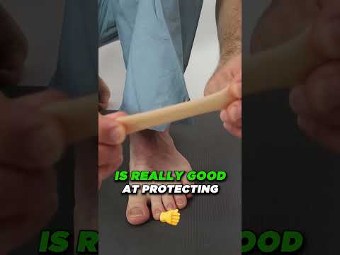 TOP 13 Ways to Shrink Bunions Naturally 1 HUGE SECRET