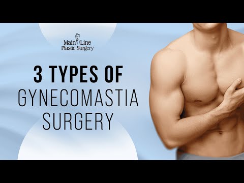 The 3 Types of Gynecomastia Surgery Explained by Dr. Raymond Jean
