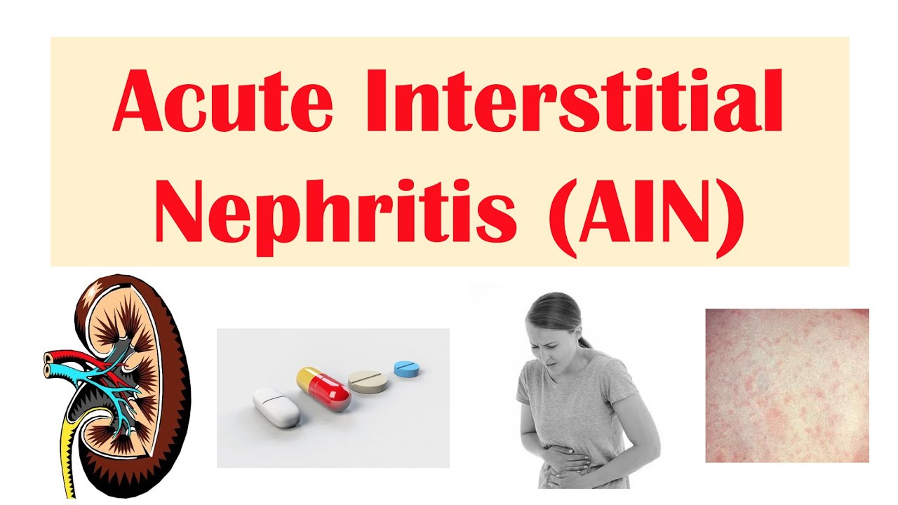 Acute Interstitial Nephritis (AIN) | Causes, Pathophysiology, Symptoms, Diagnosis, Treatment