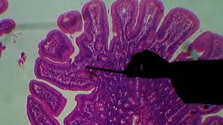 Histologia do Intestino Delgado