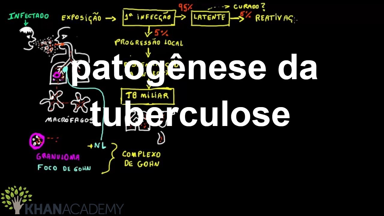 patogênese da tuberculose | Quimica | Khan Academy