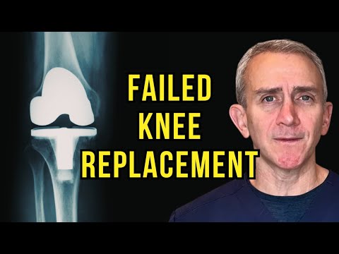 Diagnosing Knee Pain After Total Knee Replacement