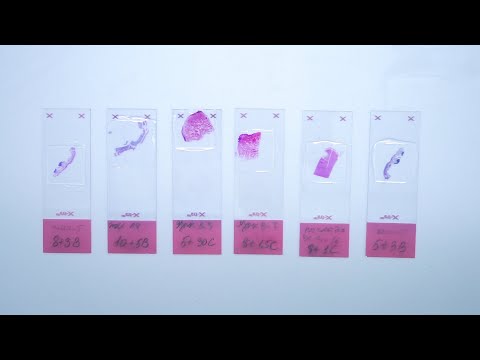 Histological staining: hematoxylin & eosin