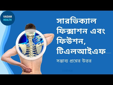 সারভিক্যাল ফিক্সাশন এবং ফিউশন টিএলআইএফ - প্রায়শই জিজ্ঞাসিত প্রশ্ন