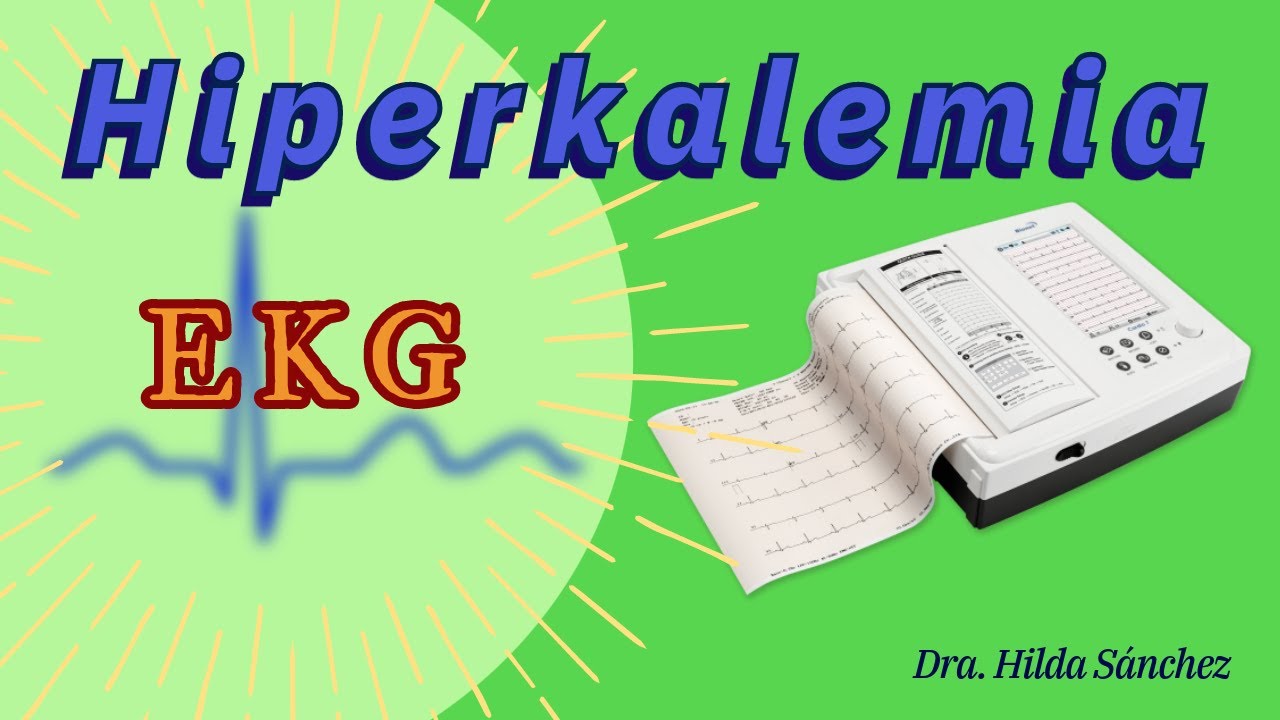 ¿Qué podemos encontrar en un EKG en pacientes con HIPERKALEMIA?