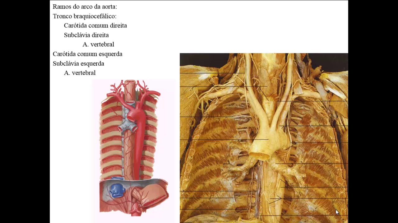 SISTEMA ARTERIAL PARTE 1 - RAMOS DA AORTA ASCENDENTE E ARCO DA AORTA