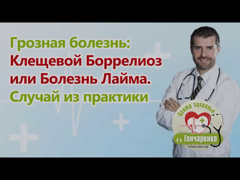 Клещевой боррелиоз или болезнь Лайма. Диагностика и лечение у пациента.