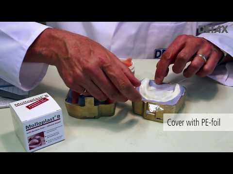 How to prepare a long term denture relining with Molloplast® B