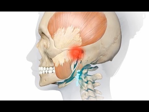 Anti-inflammatories (NSAIDs)