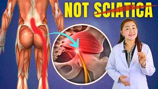 This TINY MUSCLE can FAKE SCIATICA---------------Here's How To Tell!| Doc Cherry