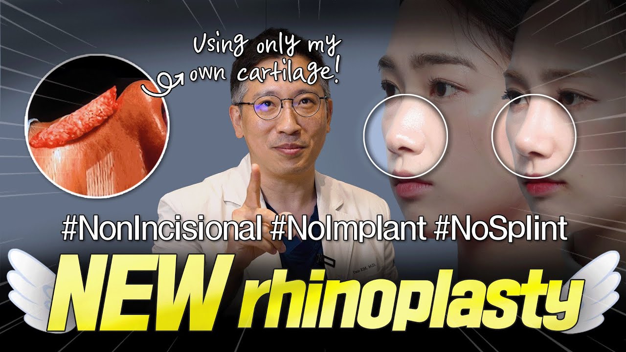 Influencer post-surgery transformation results at NANA Plastic Surgery Korea YouTube video