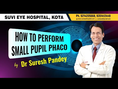 Phacoemulsification In A Small Pupil