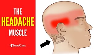 The Headache Muscle (How to Release It for INSTANT RELIEF)