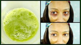 How To Get Rid Of Dark Circles Fast | Get Rid Of Wrinkles, Puffiness Under Eyes Naturally