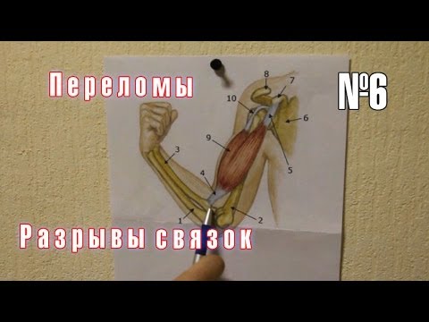 Боли в руках при шейном остеохондрозе Боль в затылке шее спине