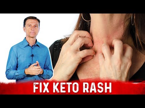 What is a Ketone Explained By Dr Berg