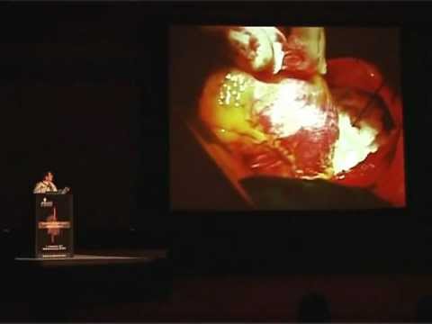 download lagu mp3 mp4 Dr Arun Mehra Cardiac Surgeon, download lagu Dr Arun Mehra Cardiac Surgeon gratis, unduh video klip Dr Arun Mehra Cardiac Surgeon