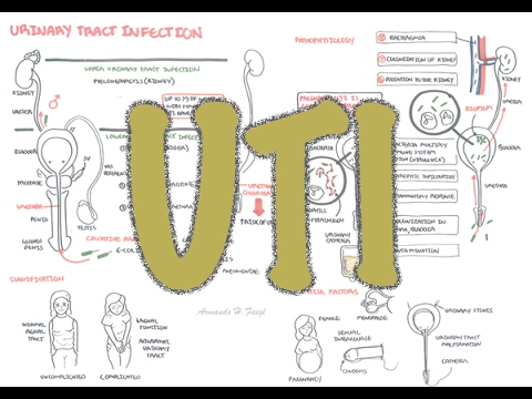 Infecciones del tracto urinario (ITU)