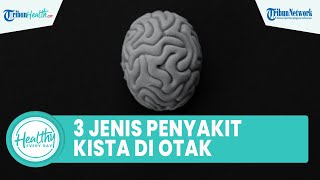 Kenali 3 Jenis Penyakit Kista di Batang Otak seperti yang Dialami Sarwendah Istri Ruben Onsu