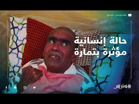 نجار حوله المرض جسده إلى مومياء.. عائلته تناشد وزير الصحة بالدموع لتشخيص حالته