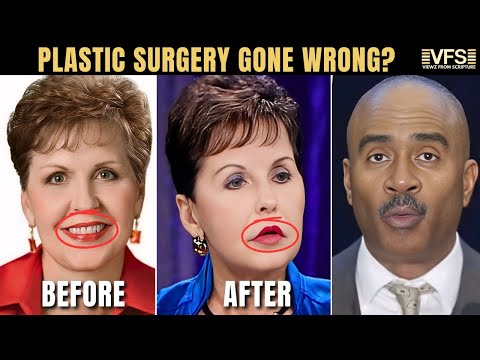 Has Joyce Meyer Had Cosmetic Surgery